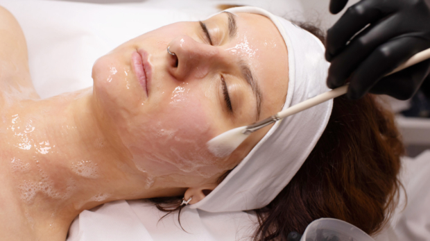 Chemical peel treatment in Riyadh