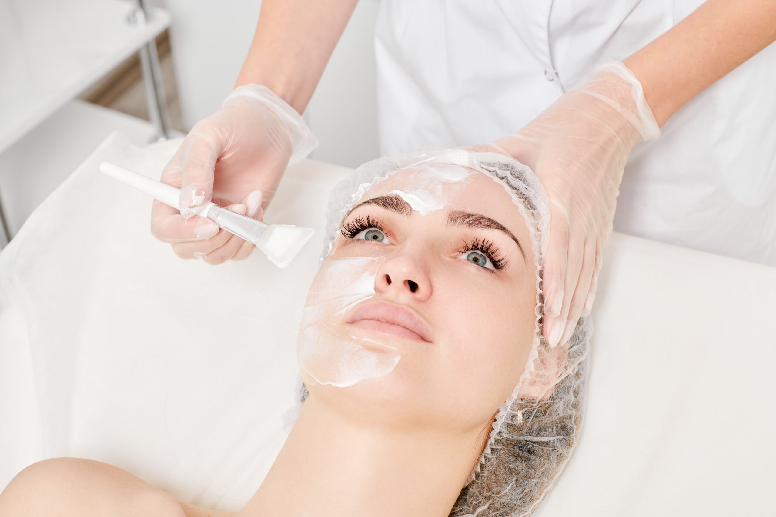 Chemical peel procedure in clinic