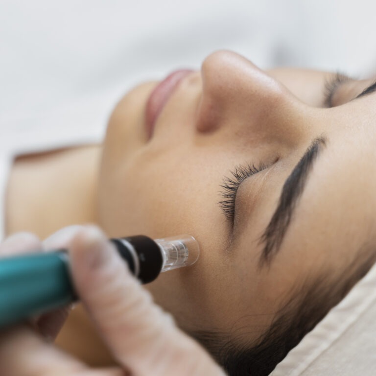 RF Microneedling in Riyadh