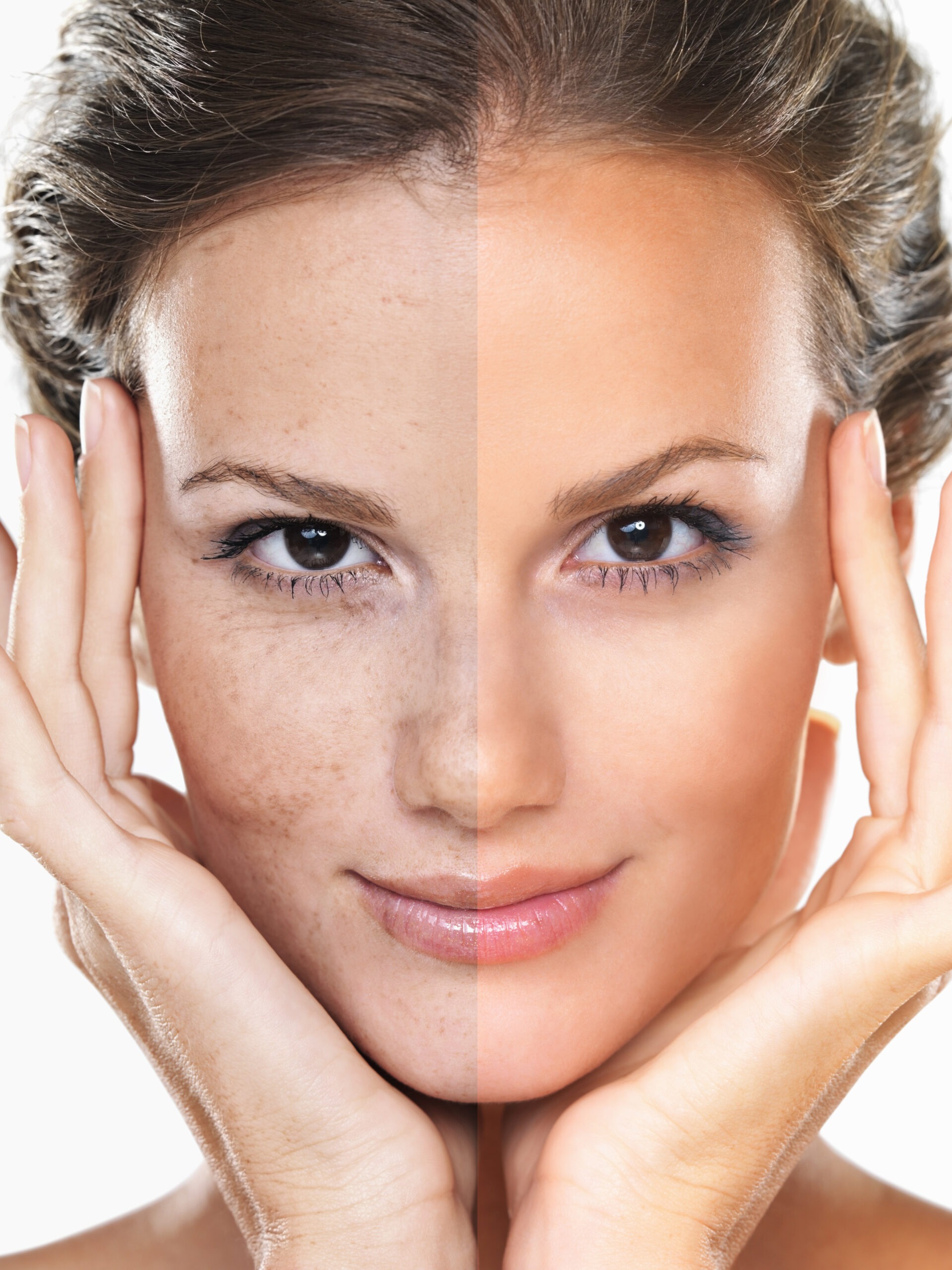 Skin brightening results before and after