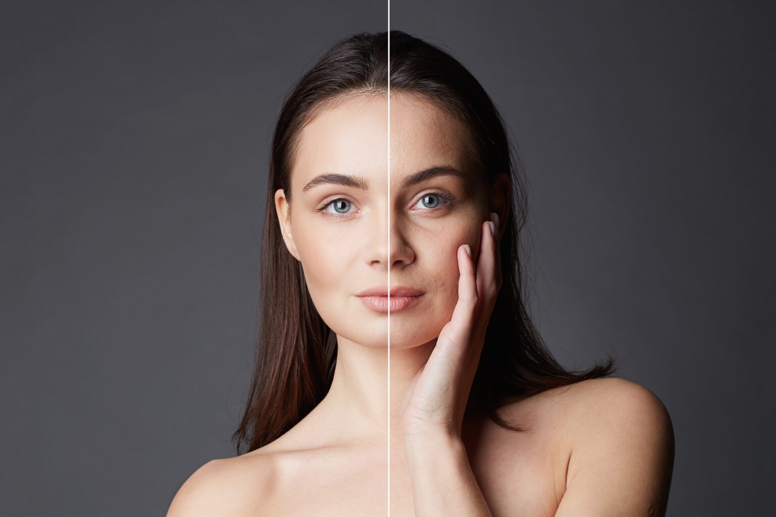 Side-by-side before and after image showing smoother, brighter skin post-microneedling.