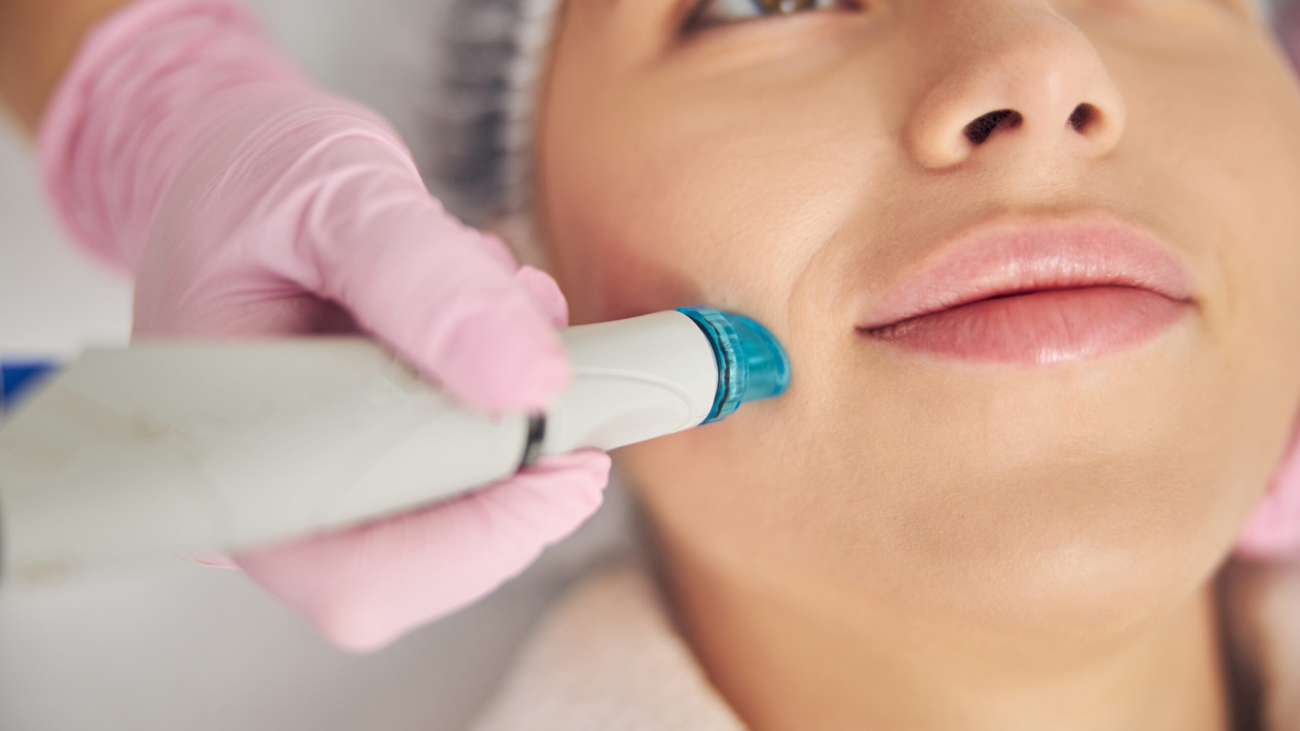 Professional microneedling treatment on facial skin