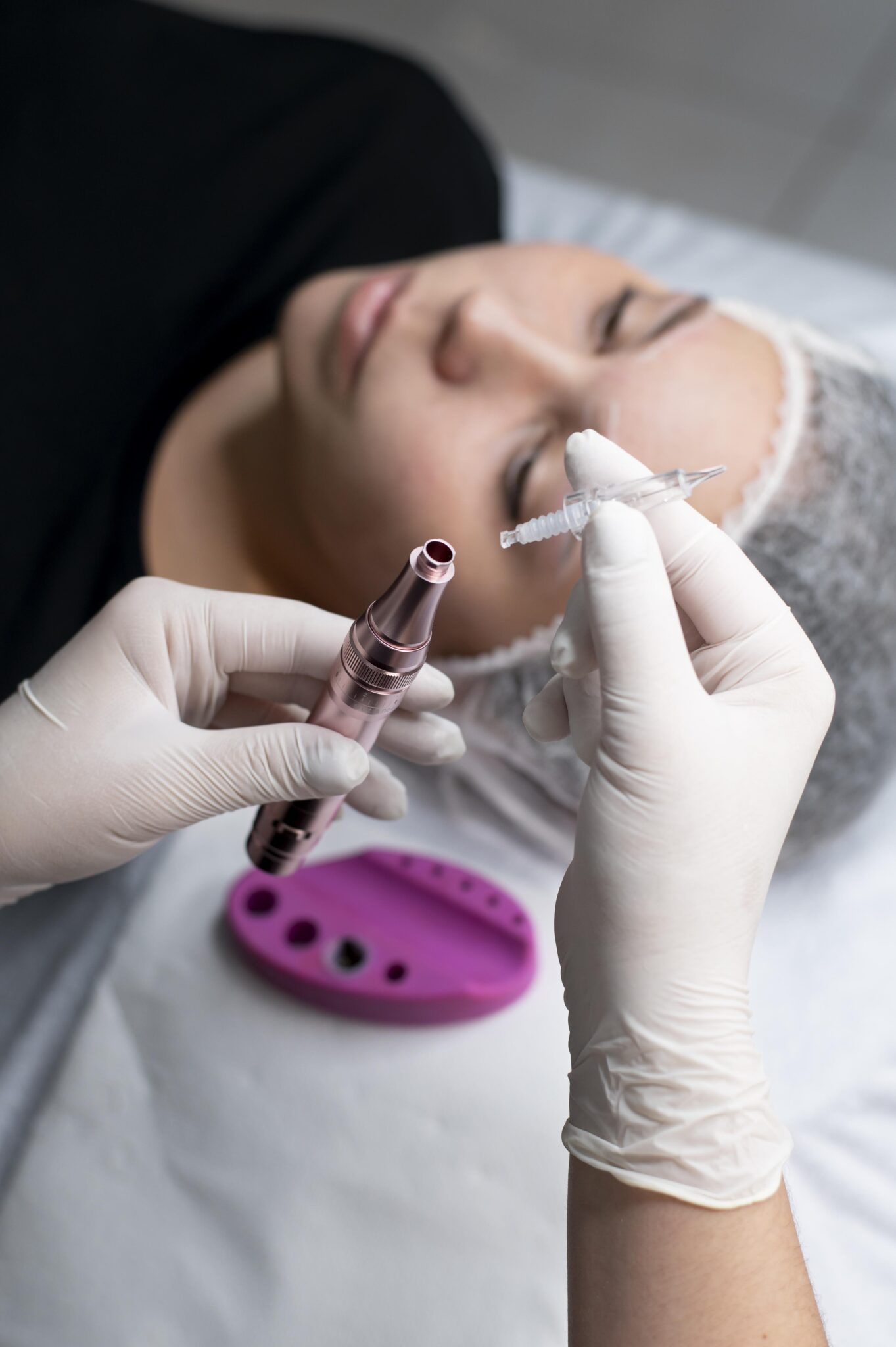 Close-up of Exosome Therapy microneedling infusion performed by Aesthetician.