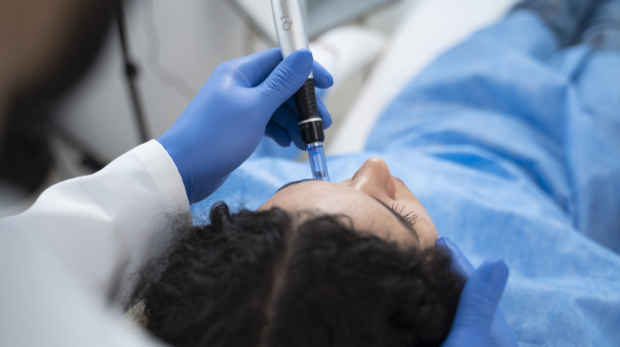 Secret RF Microneedling Treatment at Reveal Clinics Riyadh