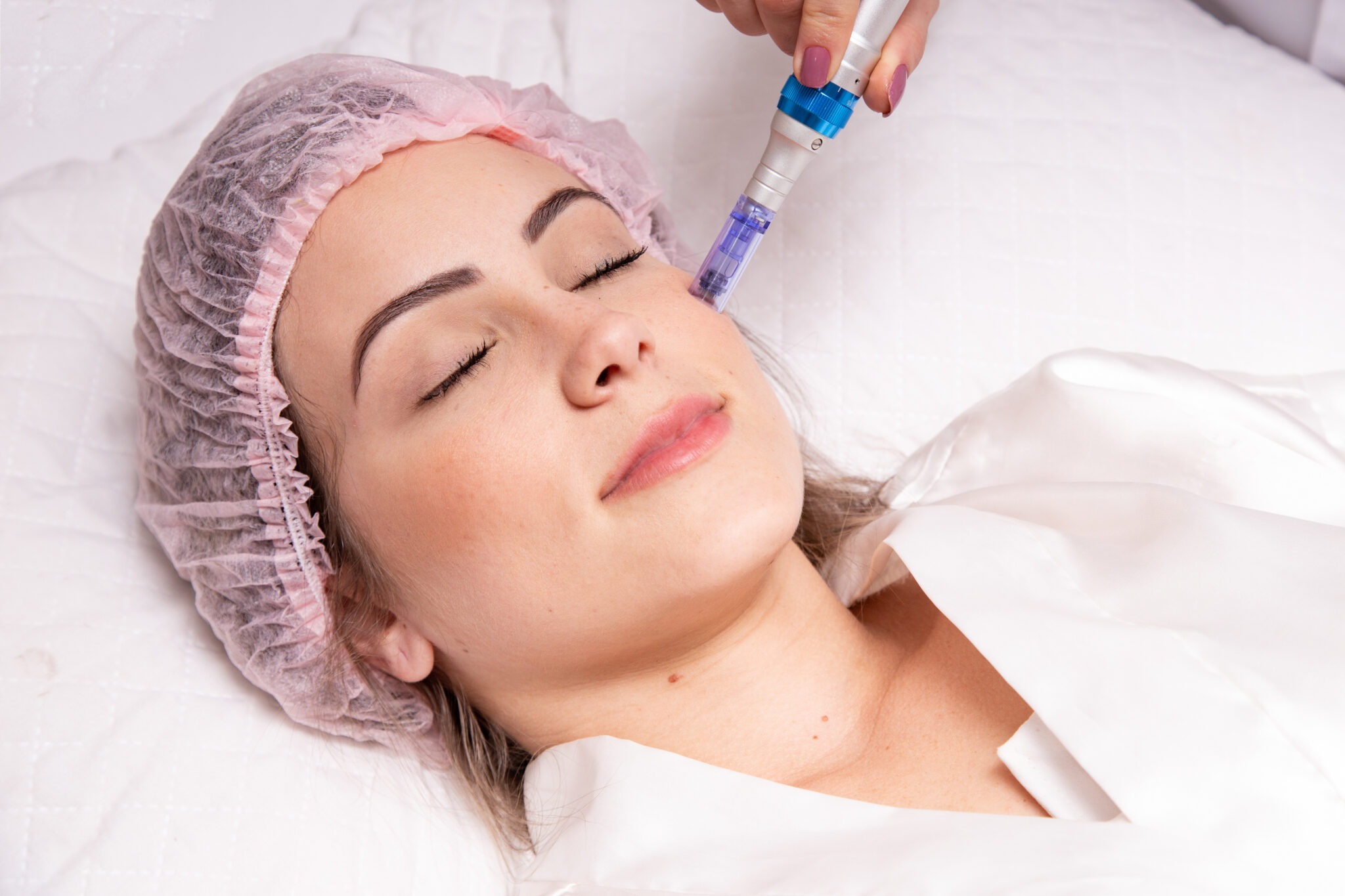 Microneedling facial with collagen stimulation