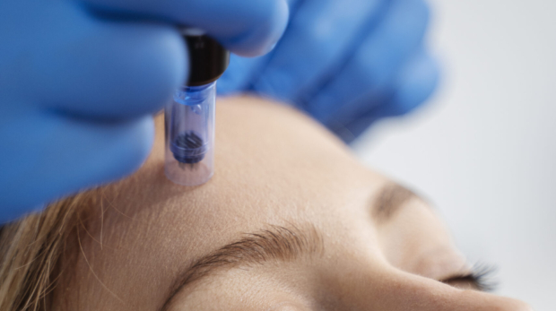 Microneedling procedure on glowing skin