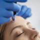 Microneedling procedure on glowing skin