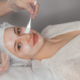 Woman receiving chemical peel in a dermatology clinic during winter