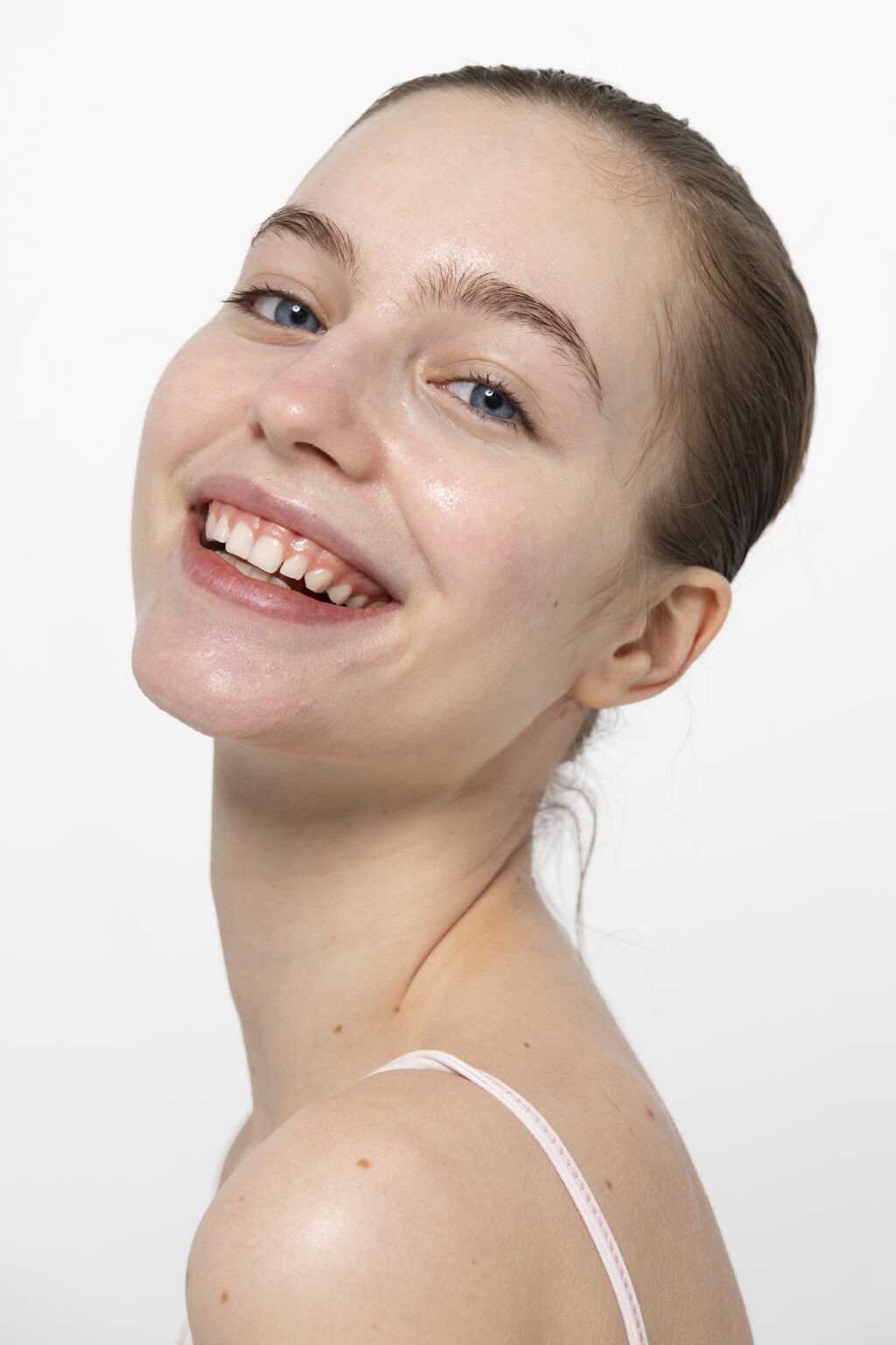 Smooth skin texture after winter chemical peel