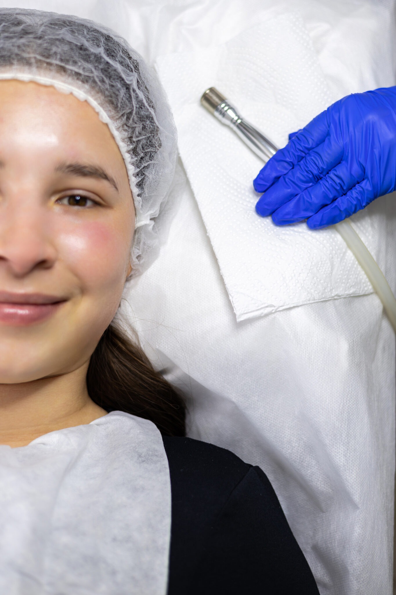 Professional skin brightening treatment in Riyadh